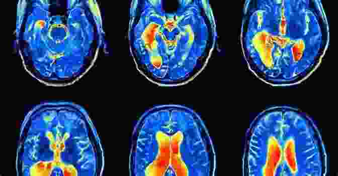 Image Of A Brain Scan Showing The Neural Activity Associated With Consciousness Humanology: A Scientist S Guide To Our Amazing Existence