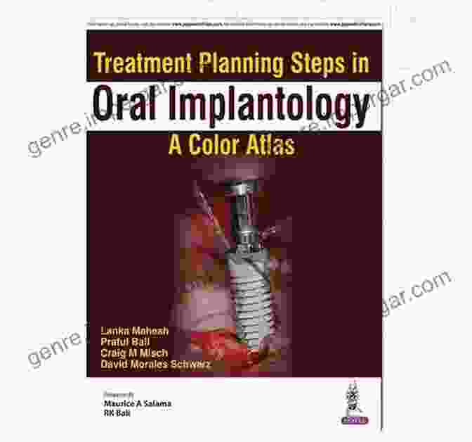 Treatment Planning Steps In Oral Implantology Treatment Planning Steps In Oral Implantology: A Color Atlas