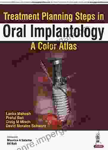 Treatment Planning Steps In Oral Implantology: A Color Atlas