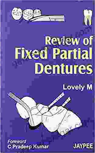 Review Of Fixed Partial Dentures