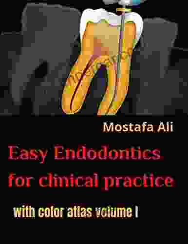 Easy endodontics for clinical practice with color atlas volume I: Endodontics textbook endodontics review step by step guide (Easy Endodontics For with color atlas: Endodontics textbook)